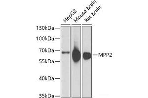 Western blot analysis of extracts of various cell lines using MPP2 Polyclonal Antibody at dilution of 1:1000. (MPP2 抗体)