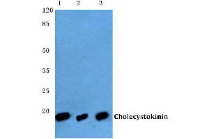 Western blot (WB) analysis of CCK antibody at 1/500 dilution (Cholecystokinin 抗体)