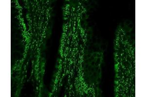 IF analysis of PTBP1 using anti-PTBP1 antibody (ABIN7599450).