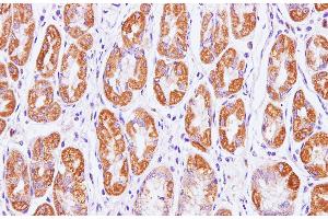 Immunohistochemistry of paraffin-embedded Human stomach using Cytochrome c1 Polyclonal Antibody at dilution of 1:100(400x) (Cytochrome C1 抗体)