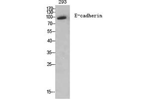 Western Blot analysis of various cells using E-cadherin Polyclonal Antibody diluted at 1:2000.