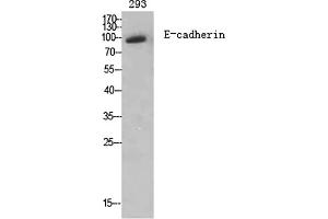 Western Blot analysis of various cells using E-cadherin Polyclonal Antibody diluted at 1:2000. (E-cadherin 抗体  (AA 810-890))