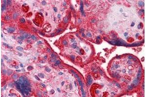Human Placenta: Formalin-Fixed, Paraffin-Embedded (FFPE) (APOA2 抗体  (AA 1-100))