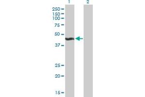 Western Blot analysis of ALG2 expression in transfected 293T cell line by ALG2 MaxPab polyclonal antibody. (ALG2 抗体  (AA 1-416))