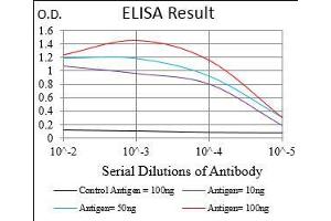 Black line: Control Antigen (100 ng), Purple line: Antigen(10 ng), Blue line: Antigen (50 ng), Red line: Antigen (100 ng), (TIE1 抗体  (AA 385-607))