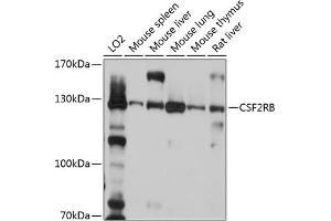Western blot analysis of extracts of various cell lines, using CSF2RB antibody (ABIN6130049, ABIN6139098, ABIN6139099 and ABIN6214780) at 1:1000 dilution. (CD131 抗体  (AA 200-443))