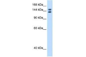 WB Suggested Anti-Mybbp1a Antibody Titration:  0. (MYBBP1A 抗体  (C-Term))