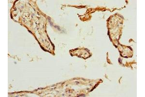 Immunohistochemistry of paraffin-embedded human placenta tissue using ABIN7176183 at dilution of 1:100 (ZNF232 抗体  (AA 1-417))
