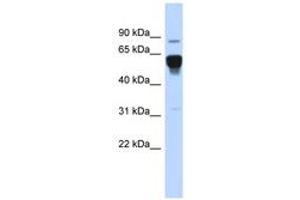 Image no. 1 for anti-Nuclear Receptor Subfamily 4, Group A, Member 2 (NR4A2) (AA 503-552) antibody (ABIN6742800) (NR4A2 抗体  (AA 503-552))