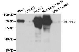 Western blot analysis of extracts of various cell lines, using ALPPL2 antibody. (ALPPL2 抗体  (AA 20-280))