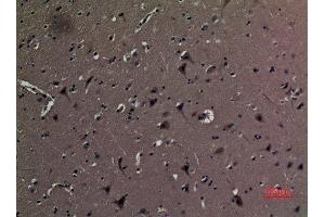 Immunohistochemistry (IHC) analysis of paraffin-embedded Human Brain, antibody was diluted at 1:100. (AAT (Internal Region) 抗体)