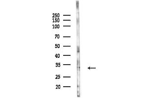 anti-Tumor Suppressing Subtransferable Candidate 4 (TSSC4) (C-Term) antibody