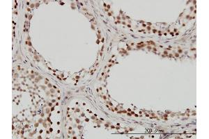 Immunostaining (ISt) image for anti-SWI/SNF Related, Matrix Associated, Actin Dependent Regulator of Chromatin, Subfamily B, Member 1 (SMARCB1) (AA 81-180) antibody (ABIN562912)