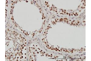Immunoperoxidase of monoclonal antibody to SMARCB1 on formalin-fixed paraffin-embedded human testis.