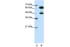SNRP70 antibody used at 0. (SNRNP70 抗体)