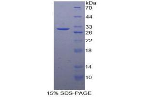SDS-PAGE analysis of Human vWA1 Protein. (VWA1 蛋白)