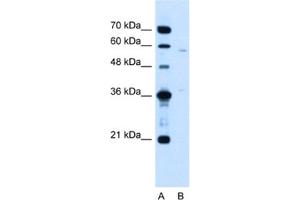 Western Blotting (WB) image for anti-MGC39633 antibody (ABIN2463995) (MGC39633 抗体)