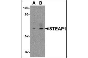 Western blot analysis of STEAP1 in human spleen tissue lysate with this product at (A) 1 and (B) 2 μg/ml. (STEAP1 抗体  (C-Term))
