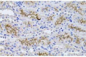 Immunohistochemistry of paraffin-embedded Rat kidney using GGT1 Polyclonal Antibody at dilution of 1:100 (40x lens). (GGT1 抗体)
