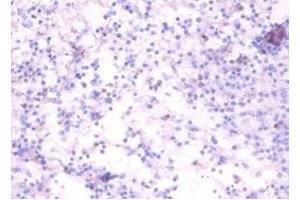 Immunohistochemistry of paraffin-embedded human spleen tissue using ABIN7173868 at dilution of 1:100 (RELT 抗体  (AA 26-153))