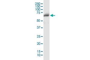 CFHR5 MaxPab polyclonal antibody. (CFHR5 抗体  (AA 1-569))