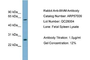 WB Suggested Anti-BIVM  Antibody Titration: 0. (BIVM 抗体  (Middle Region))