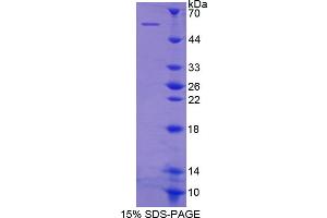 SDS-PAGE analysis of Human Integrin beta 1 Protein. (ITGB1 蛋白)