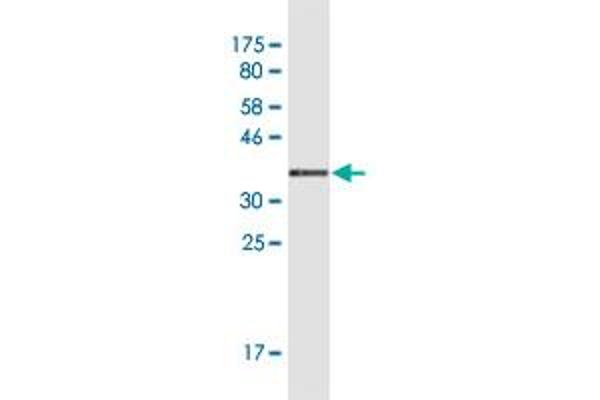 Glycogen Synthase 2 抗体  (AA 1-100)