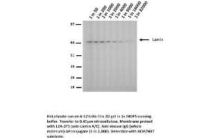 Image no. 1 for anti-Lamin A/C (LMNA) (Arg453Trp-Mutant) antibody (ABIN1042618) (Lamin A/C 抗体  (Arg453Trp-Mutant))