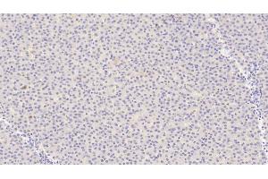 Detection of ANGPT1 in Human Liver Tissue using Polyclonal Antibody to Angiopoietin 1 (ANGPT1) (Angiopoietin 1 抗体  (AA 284-452))