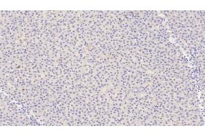 Detection of ANGPT1 in Human Liver Tissue using Polyclonal Antibody to Angiopoietin 1 (ANGPT1) (Angiopoietin 1 抗体  (AA 284-452))