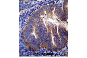 KLC2 Antibody (N-term) (ABIN656175 and ABIN2845505) immunohistochemistry analysis in formalin fixed and paraffin embedded human uterus tissue followed by peroxidase conjugation of the secondary antibody and DAB staining. (KLC2 抗体  (N-Term))