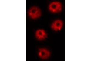 ABIN6267639 staining COS7 by IF/ICC. (PIN1 抗体  (pSer16))