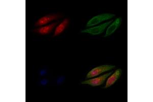 ABIN6259560 and ABIN6275550 staining Hela cells by IF/ICC.