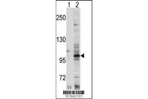 Western blot analysis of EPHA7 using EphA7 Antibody using 293 cell lysates (2 ug/lane) either nontransfected (Lane 1) or transiently transfected with the EPHA7 gene (Lane 2). (EPH Receptor A7 抗体  (C-Term))