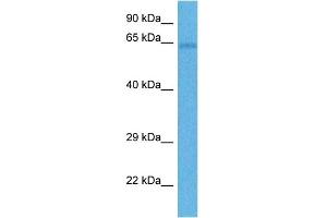 Host:  Rabbit  Target Name:  FZD4  Sample Tissue:  Human Lung Tumor  Antibody Dilution:  1ug/ml (FZD4 抗体  (Middle Region))