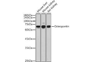Western blot analysis of extracts of various cell lines, using Osteopontin antibody (ABIN3021921, ABIN3021922, ABIN3021923 and ABIN6217674) at 1:1000 dilution. (Osteopontin 抗体  (AA 17-314))