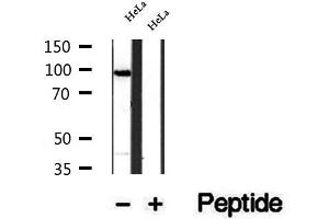 Western blot analysis of extracts of HeLa cells, using SECISBP2 antibody. (SECISBP2 抗体  (Internal Region))