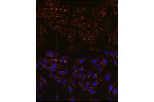 Immunofluorescence analysis of C6 cells using IFN Rabbit pAb (ABIN7267947) at dilution of 1:100 (40x lens). (IFNAR1 抗体  (AA 470-557))