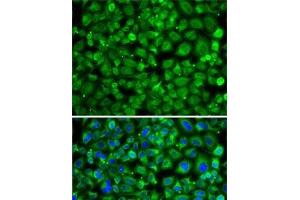 Immunofluorescence analysis of A-549 cells using SAT2 Polyclonal Antibody (SAT2 抗体)