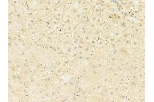 ABIN6259716 and ABIN6273088 at 1/100 staining human normal liver tissue by IHC-P.