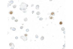 Immunocytochemistry (ICC) image for anti-DYKDDDDK Tag (Cleavage Site) antibody (ABIN7453373) (Recombinant DYKDDDDK Tag 抗体  (Cleavage Site))