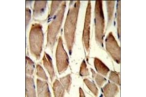 Formalin-fixed and paraffin-embedded human skeletal muscle reacted with RRM2 Antibody (Center), which was peroxidase-conjugated to the secondary antibody, followed by DAB staining. (RRM2 抗体  (AA 96-125))
