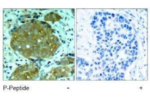 Image no. 1 for anti-Nuclear Factor of kappa Light Polypeptide Gene Enhancer in B-Cells 1 (NFKB1) (pSer932) antibody (ABIN197008) (NFKB1 抗体  (pSer932))