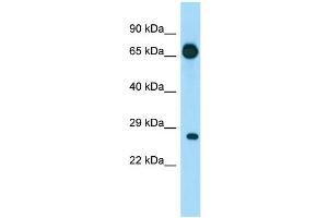 WB Suggested Anti-EIF4E1B Antibody Titration: 1. (EIF4E1B 抗体  (N-Term))