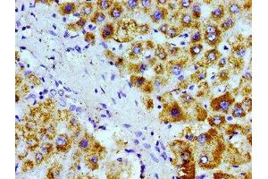 Immunohistochemistry of paraffin-embedded human liver tissue using ABIN7168945 at dilution of 1:100 (AGXT 抗体  (AA 112-294))