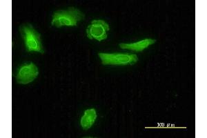 Immunofluorescence (IF) image for anti-Low Density Lipoprotein Receptor Adaptor Protein 1 (LDLRAP1) (AA 1-263) antibody (ABIN565226)