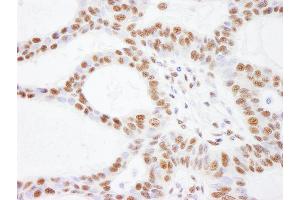 Immunohistochemistry (IHC) image for anti-SWI/SNF Related, Matrix Associated, Actin Dependent Regulator of Chromatin, Subfamily C, Member 2 (SMARCC2) (C-Term) antibody (ABIN7454712)