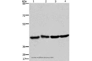 Western blot analysis of Human fetal liver and brain tissue, 293T and Hela cell, using DRG1 Polyclonal Antibody at dilution of 1:350 (DRG1 抗体)