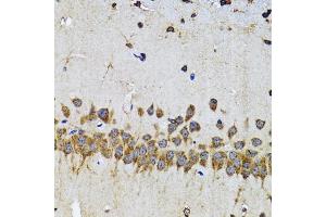 Immunohistochemistry of paraffin-embedded mouse brain using EFNB2 antibody (ABIN5973311) at dilution of 1/100 (40x lens). (Ephrin B2 抗体)